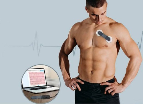 Langzeit ekg monitor - langzeit, ekg-monitor