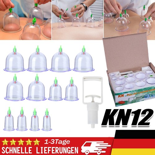 Tlg schröpfen set - schröpfen, für