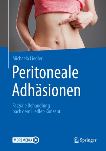 Michaela liedler peritoneale - liedler,