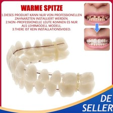Snap On Veneers Kosmetische