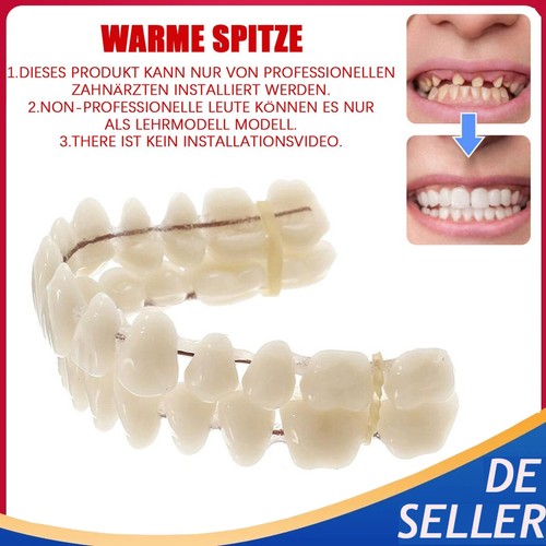 Snap veneers kosmetische - on,
