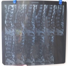 Menschliche Lendenwirbelsäule - Medizinischer MRT-Scan Negativfilmdruck - M.R.I. Röntgenbilder