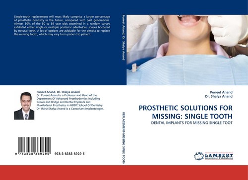 Prosthetic solutions for - prosthetic,