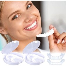 Künstliche Zähne, Veneers