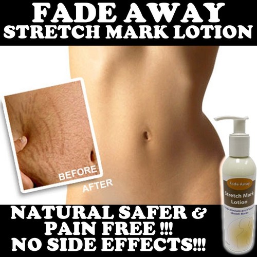 Lotion zur reduzierung - lotion,