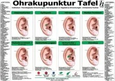 Ohrakupunktur Tafel -