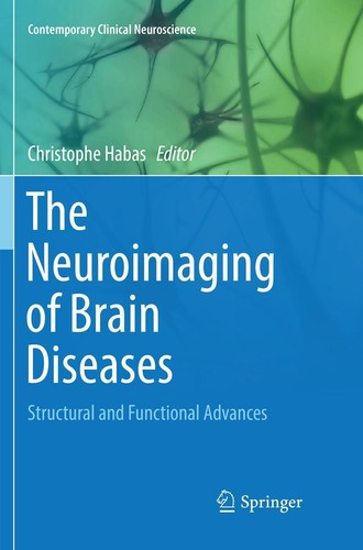 The neuroimaging brain - the, of