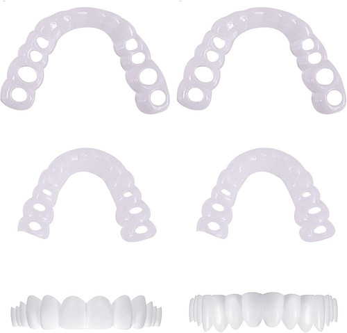 Temporäre veneers zahnersatz - temporäre,