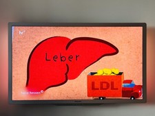 Philips Ambi-Light TV mit 2x