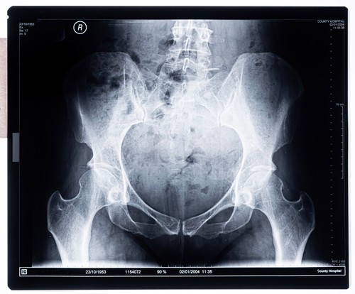 Original krankenhaus - original,