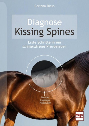 Diagnose kissing spines - diagnose,