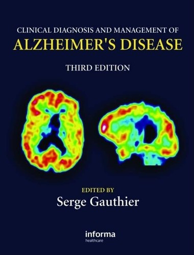 Clinical diagnosis and - clinical,