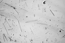 Kieselalgen Objektträger, RI Firth, Cuba Strew, Amphipleura lindheimeri