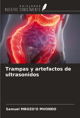 Trampas artefactos de - artefactos,