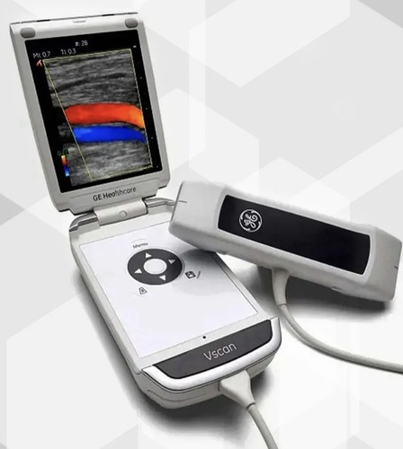 Vscan ultraschallsystem mit - vscan,