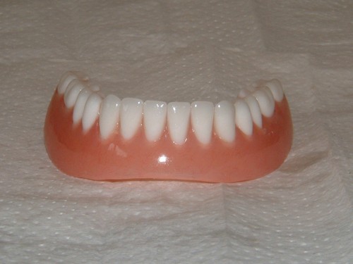 Zahnprothese,zahnersatz,prothe