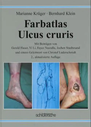 Farbatlas ulcus cruris - farbatlas,