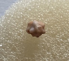 Parindocrinus oyensi