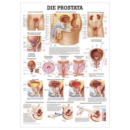 Die prostata lehrtafel - die,