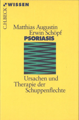 Psoriasis ursachen und - ursachen,