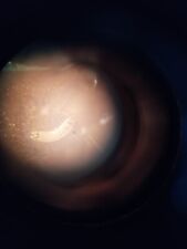 Bernstein Inkluse  Einschluss