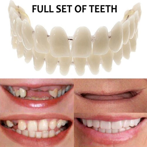Snap veneers kosmetische - on,