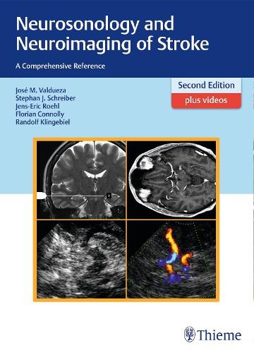 Neurosonology and neuroimaging - neurosonology,