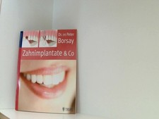 Zahnimplantate & Co.: Die
