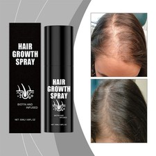 50ml haarwachstumsspray - 50ml,