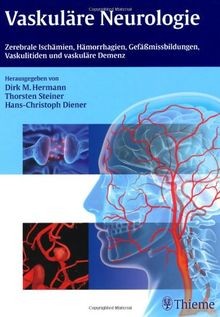 Vaskuläre neurologie - vaskuläre,