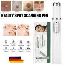 Blaulicht Muttermal Entfernen