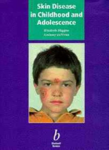 Skin disease childhood and - skin,