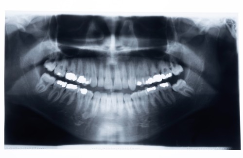 Original panorama dental - original,