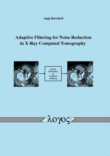 Adaptive filtering for - filtering, noise