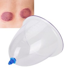 Extra Large PC Single Cupping Cup Health Care Körpermassagegerät Gerät NTS