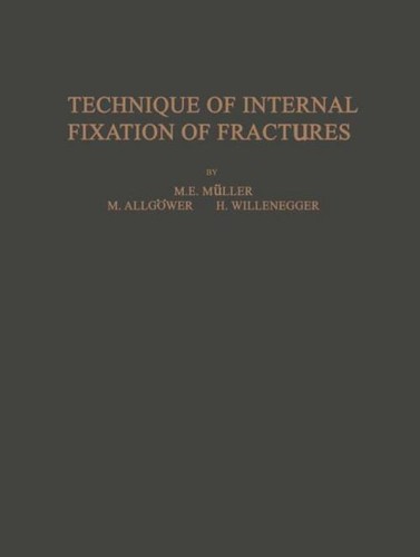 Technique internal fixation - of,
