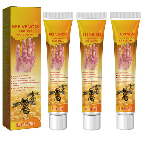 Bee venom psoriasis - bee,