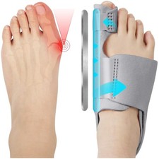 Hallux Valgus Korrektur