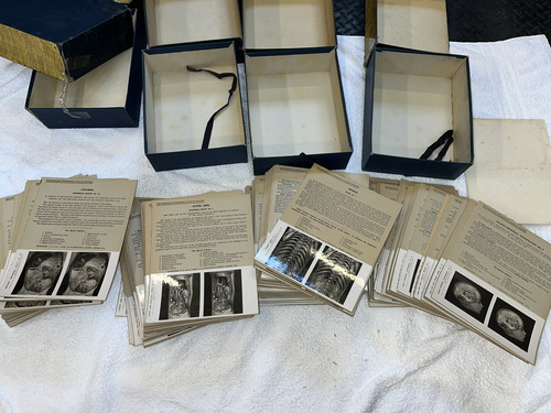 The edinburgh stereoscopic - the,
