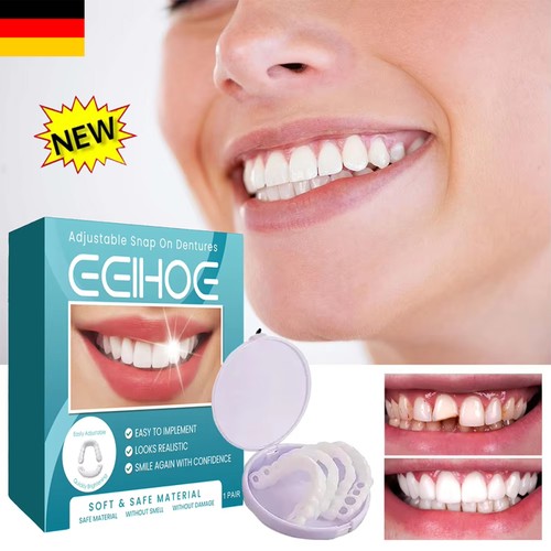 Smile snap falsche zähne - falsche,