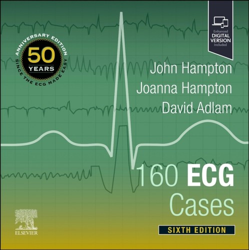 160 ecg cases david - 160,