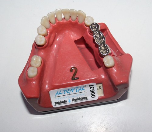Dent schaumodell - dent, #