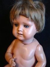 Bruno Schmidt, Herzbaby