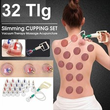 32tlg Schröpfen mit