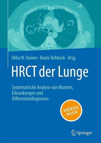 Hrct der lunge - der,