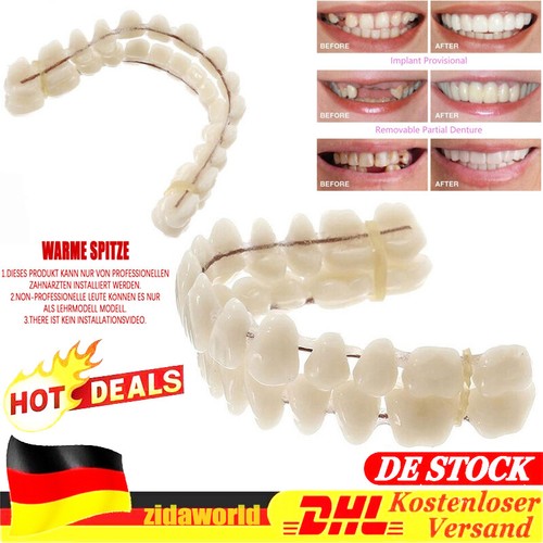 Snap veneers kosmetische - snap, on