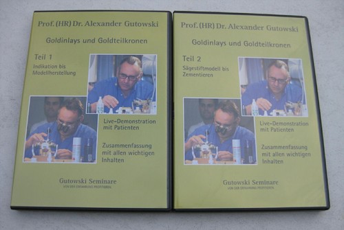 Goldinlays und goldteilkronen - goldinlays,