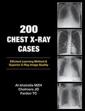200 chest ray cases - cases, new
