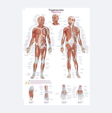 Lehrtafel "Triggerpunkte" | Poster 70 x 100 cm | Metall-Leiste