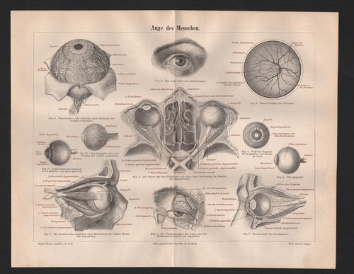 Lithograph 1893 eye man - lithograph,